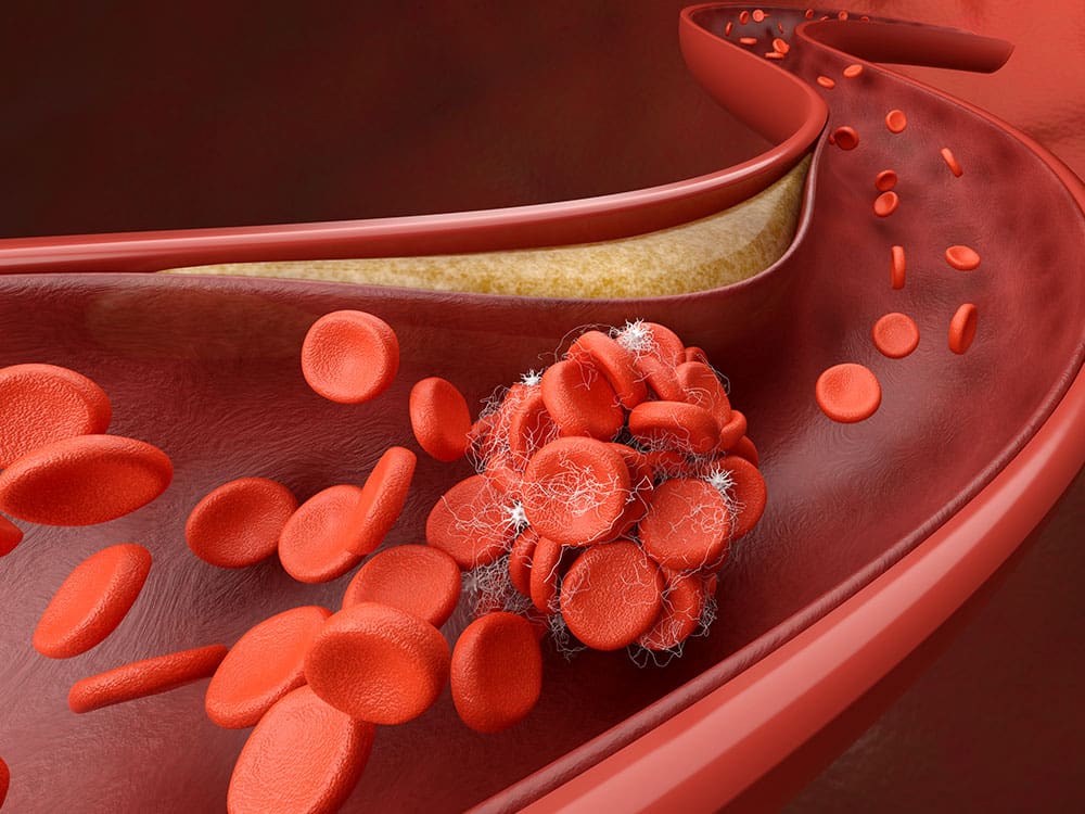 I Congreso Internacional de Ateroesclerosis en Castilla Rural